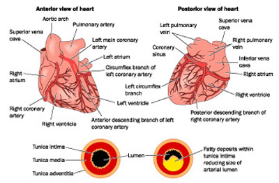 Heart_Disease_Scan_Blog_Apr.jpg